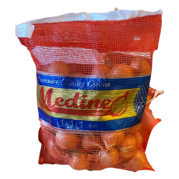 Big Onions – Red & Brown Varieties, Bulk & Pack Options - Image 4